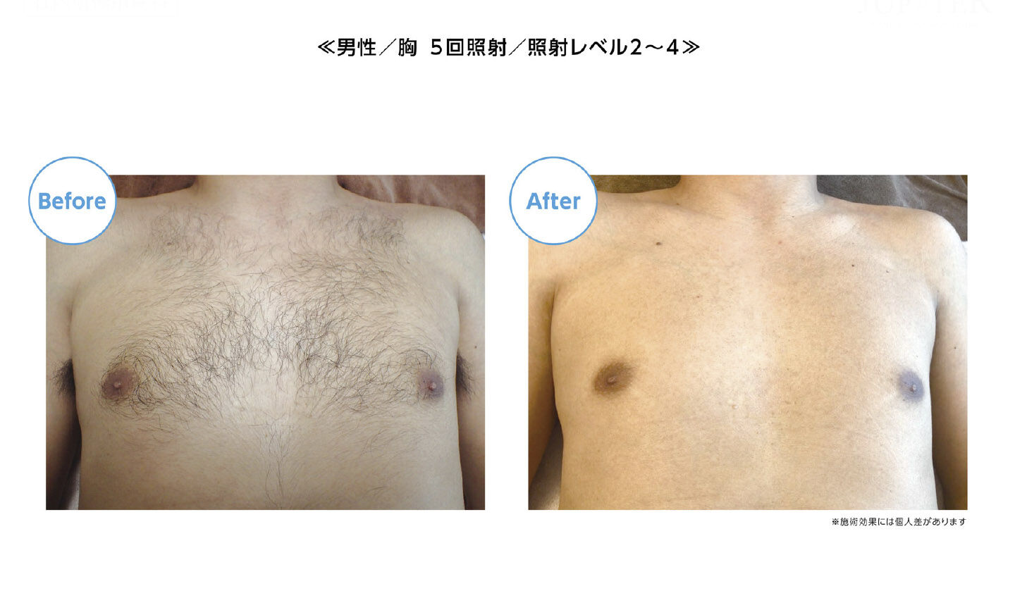 B&A